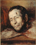 Kopf von Giuseppe Fieschi 1790-1836 nach seiner Hinrichtung - Jacques-Raymond Brascassat — Ansicht des Kunstwerks