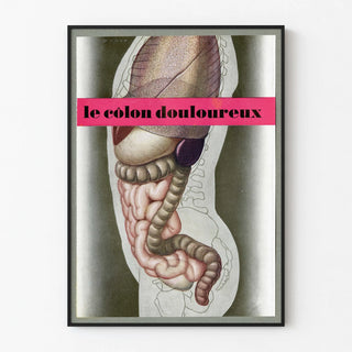 le-colon-douloureux