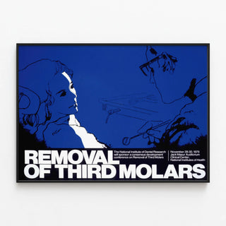 removal-of-third-molars